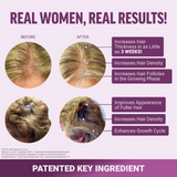 Hair Boost Accelerator