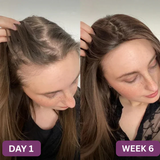 Hair Boost Accelerator