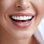 Invisible Orthodontic Veneers